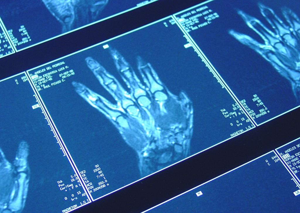 multiple-mri-pictures-of-hand